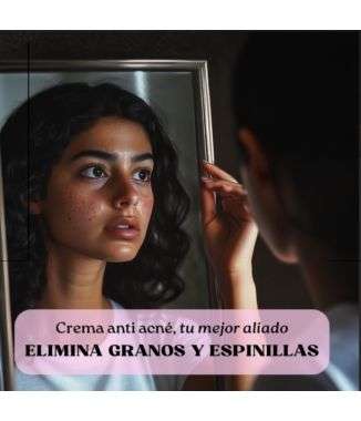 Crema Antiacné de Noche